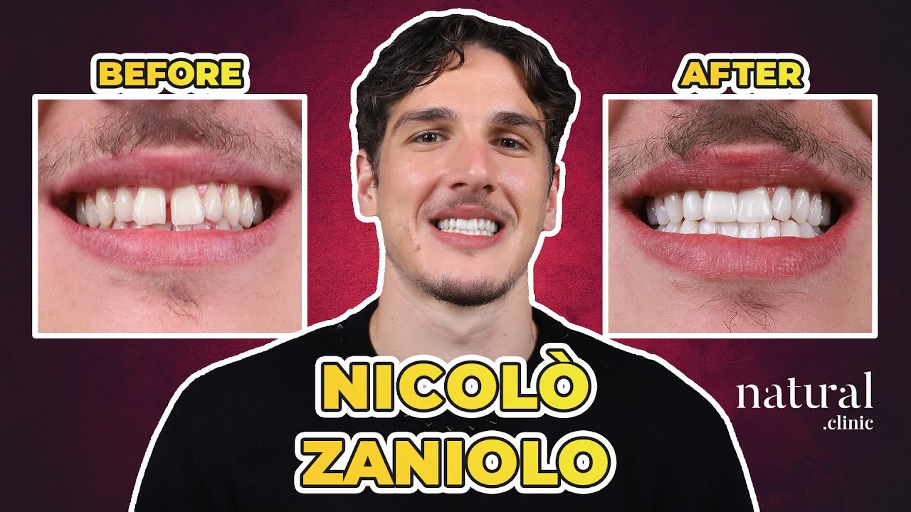 Milda Clinic hasta videosu
