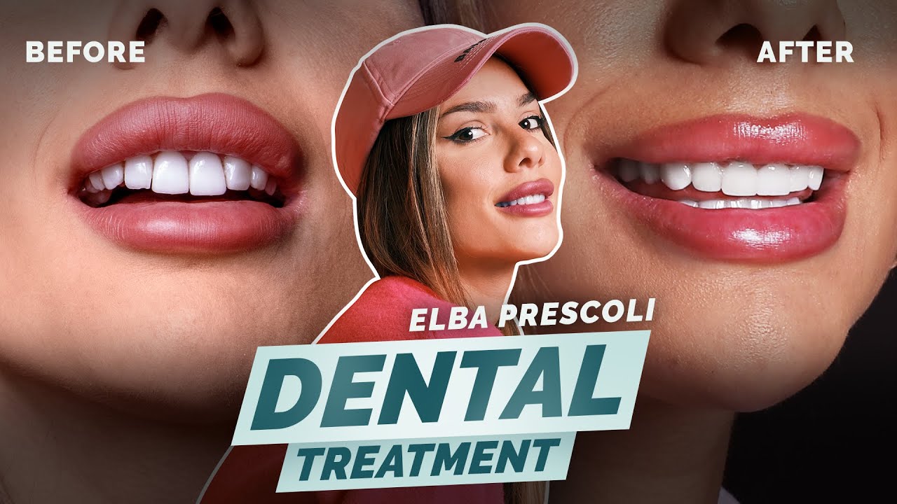 Milda Clinic hasta videosu